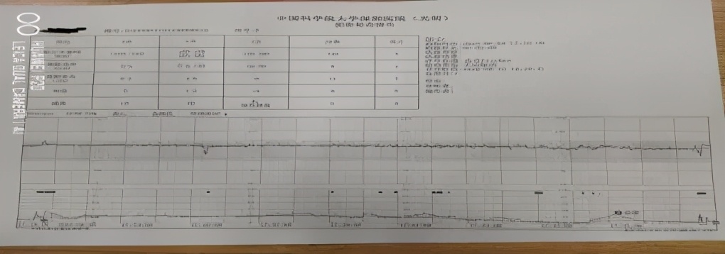 胎儿窘迫案例分析题,胎儿窘迫抢救视频