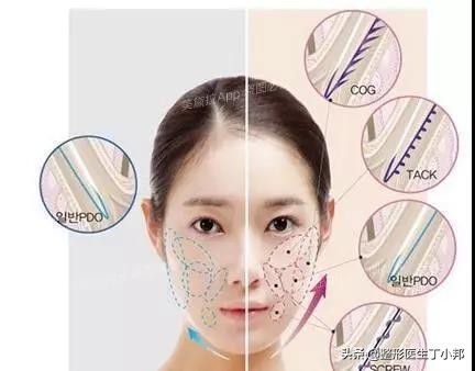 线雕的作用原理视频教学,线雕原理是什么