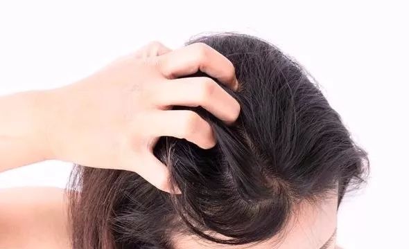 头屑用康王越洗越多,头屑越洗越多越严重