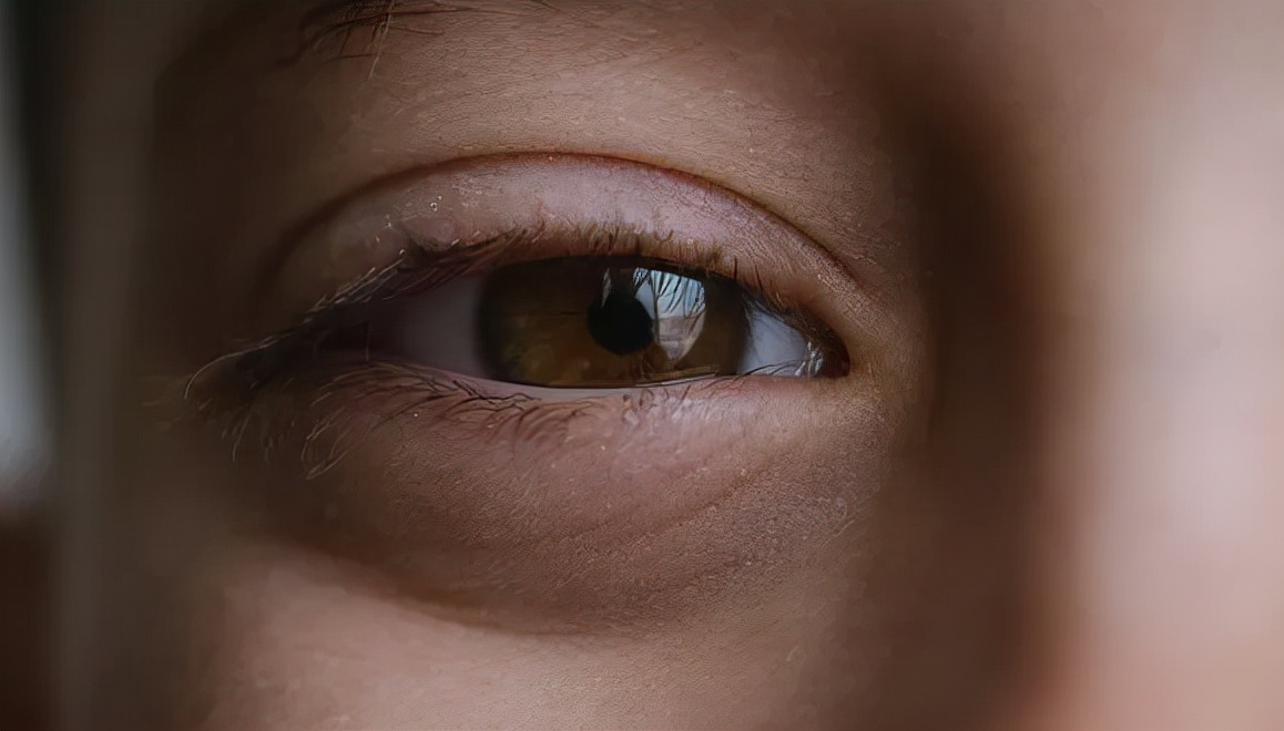 男性黑眼圈产生的原因,人多大年纪会产生黑眼圈