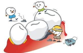 牙齿臭有牙结石怎么去除,牙黄有口臭有牙结石怎么办