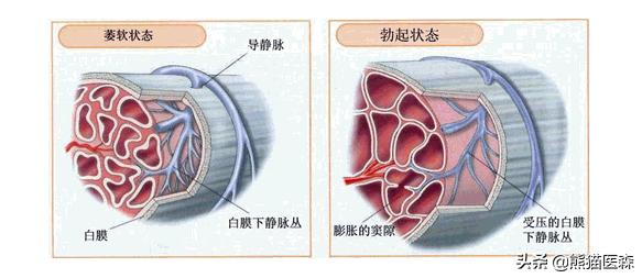 男士负压真空泵能长期用吗,男性真空负压器真的有用吗