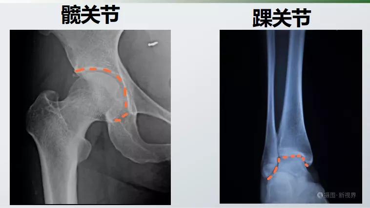全身关节都有毛病怎么治,膝关节为什么会发炎