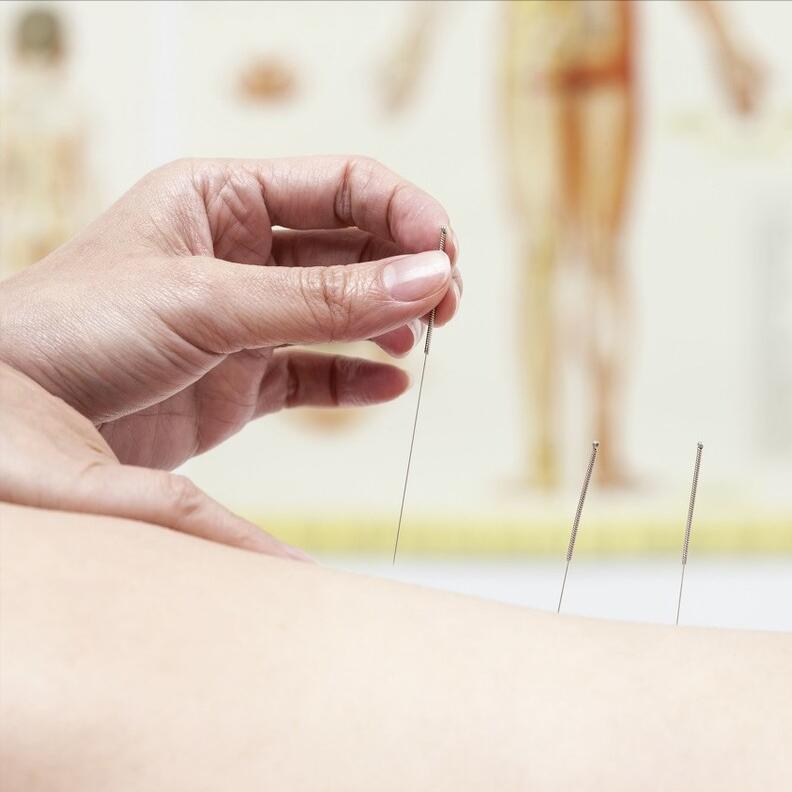 神奇的针灸一针下去就好了,神奇的针灸