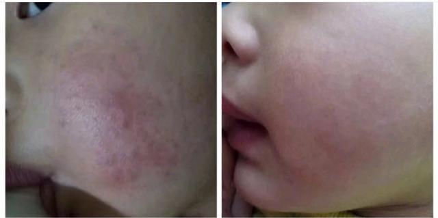 宝妈推荐的面霜第一名,宝妈推荐幼儿面霜美白