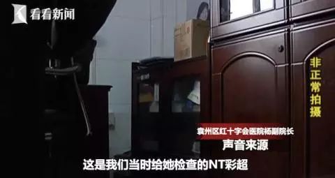 产检小孩唇腭裂是为什么,发现胎儿唇裂孕期补救办法