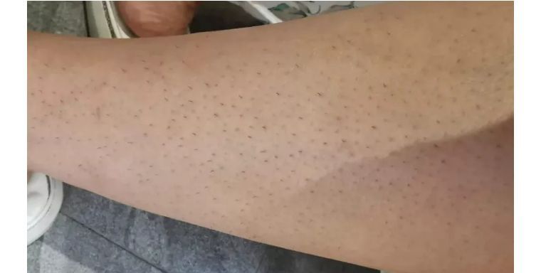 j-style脱毛仪测评,j-style美容仪好用吗