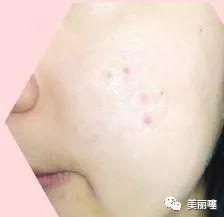 欧阳娜娜推荐的美白神器,欧阳娜娜推荐的祛痘神器