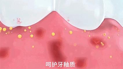 牙黄口臭怎么办用什么牙膏,黄牙口臭解决方法牙膏