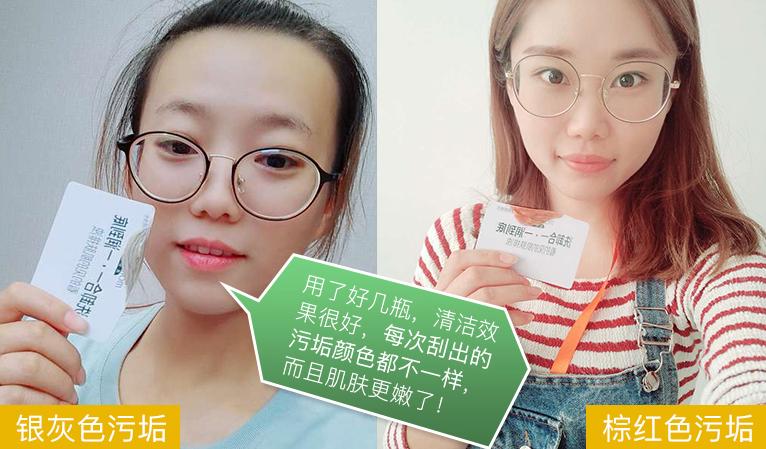 黑头疯长,口罩一摘吓死人?用它揉一揉,毛孔垃圾全吸走