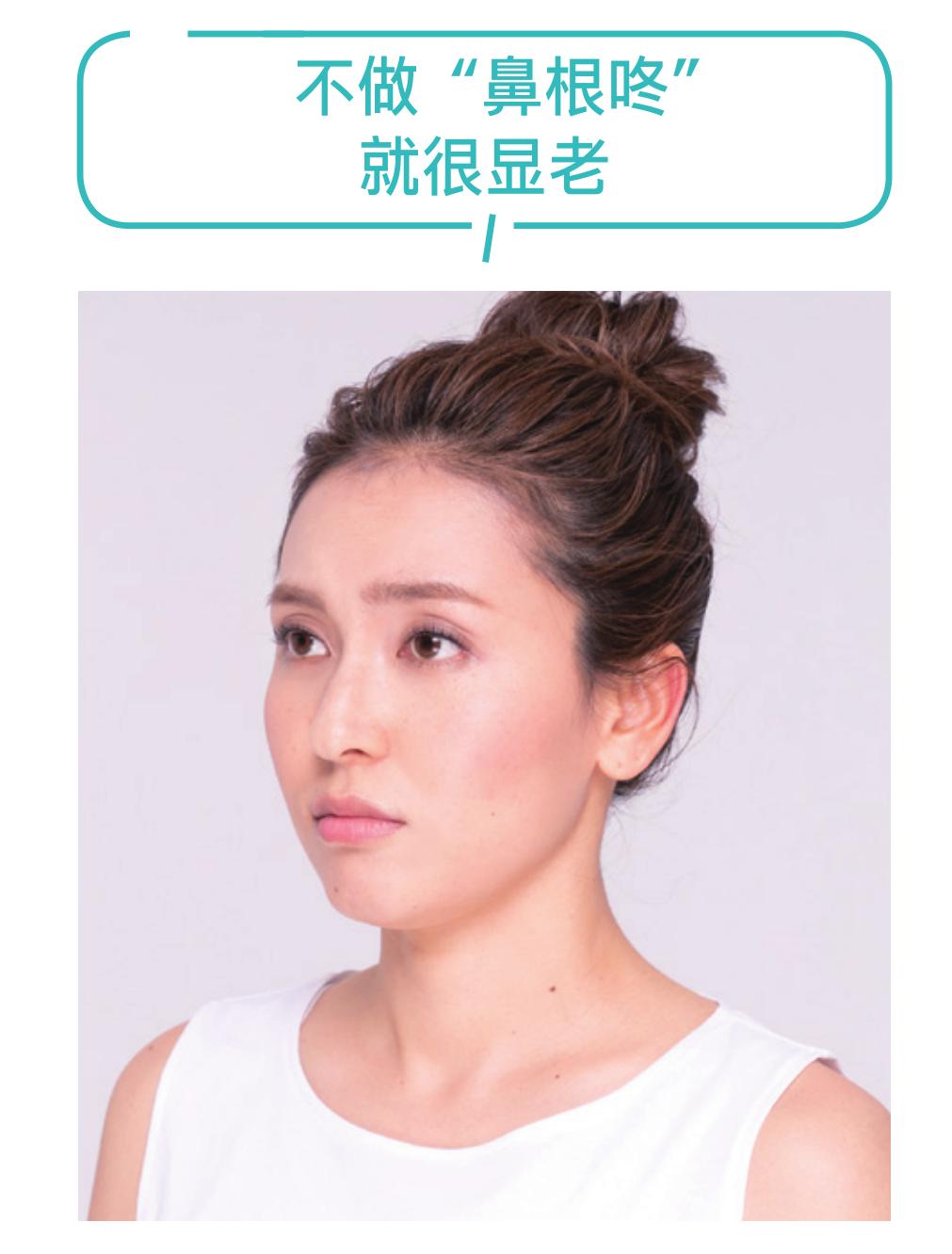 《中国医生》“眼技”大赏，锻炼眼部肌肉预防衰老