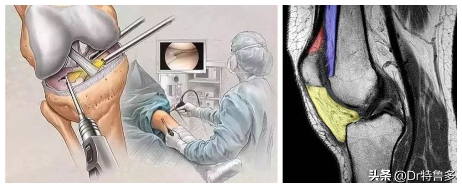 膝盖疼应该知道的几件事,膝眼痛考虑何病