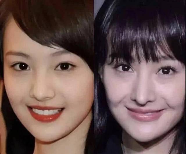 如何分辨鼻子整没整过,如何辨别鼻子有没有整过