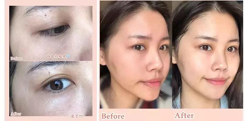 新西兰8分钟面膜真的好吗,新西兰八分钟面膜使用方法