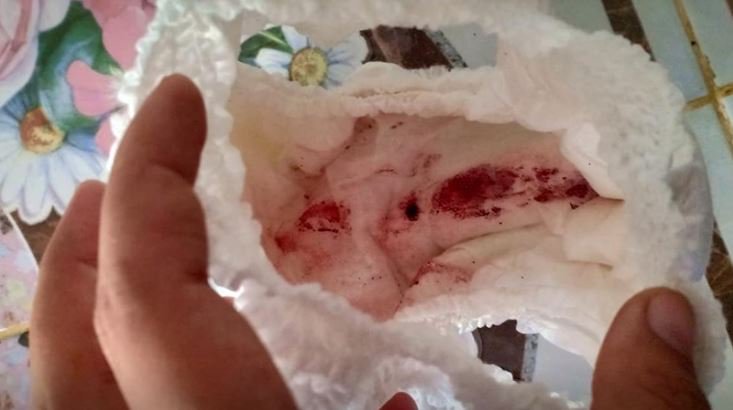 女子河边游玩不慎陷入黄河沼泽,女生下水游泳被水蛭咬住了