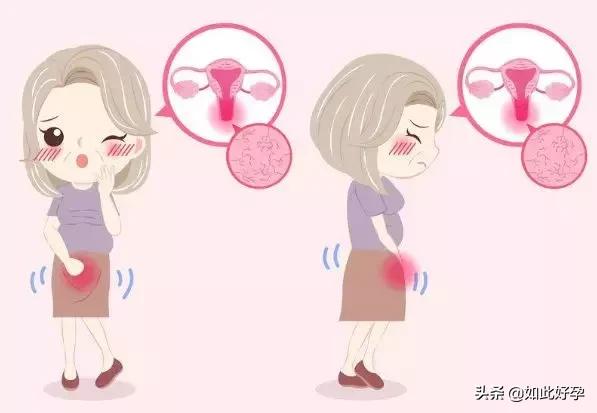 ella产后尿失禁案例,ella产后后遗症