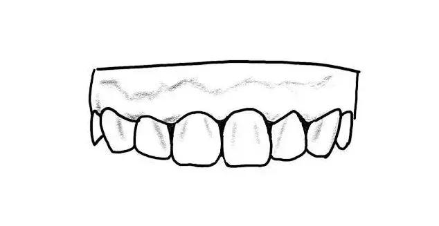 整牙给你点靠谱的建议,整牙亲身经历经验分享