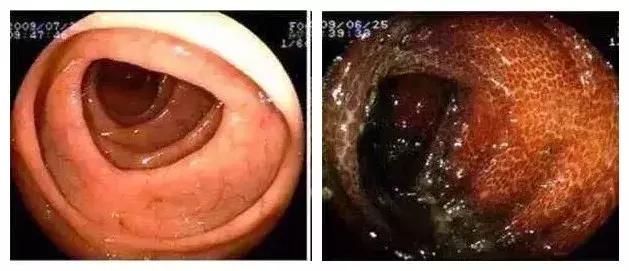 瘦身药的危害,药肥对人体有害吗