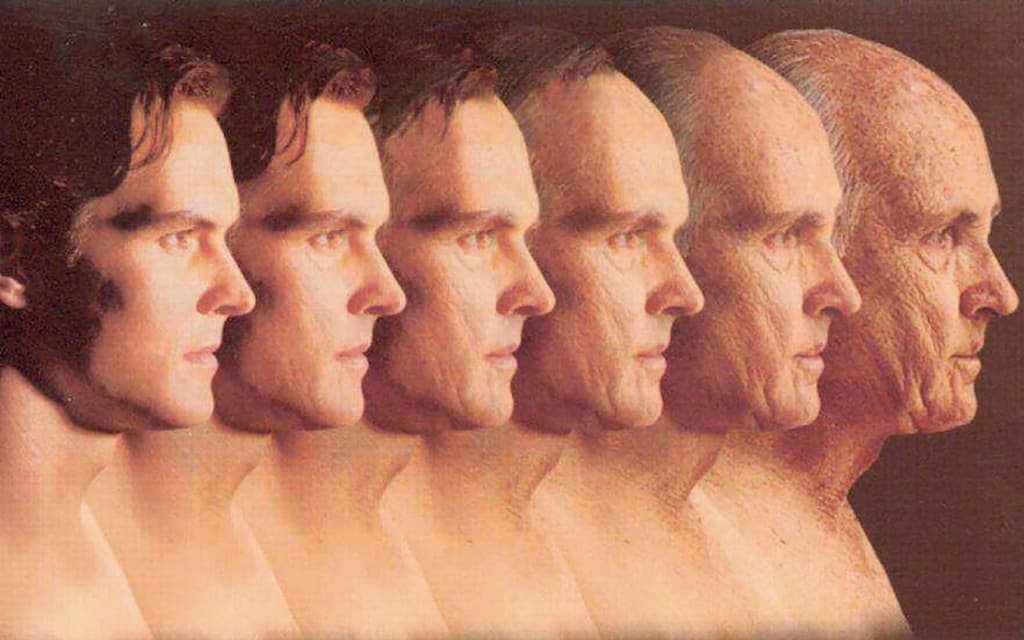 中年男性脱发原因及治疗方法,中年男性遗传性脱发能治好吗