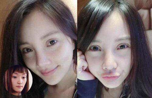 原来双眼皮不好看有必要继续割吗,双眼皮越看越奇怪怎么办