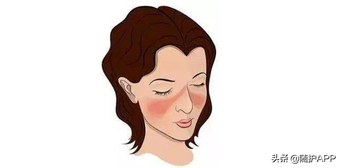 hiv的小红疹长什么样,hiv的小红点是病毒疹吗