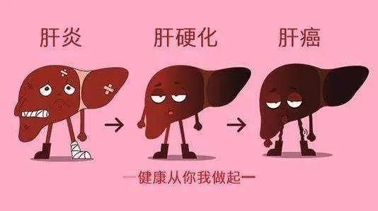 益生菌能防癌致癌吗,益生菌与肝癌有什么关系