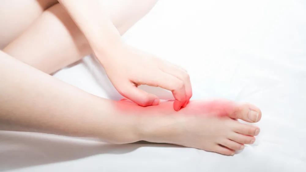 脚气反复发作一招轻松缓解,脚气好得快用什么小妙招