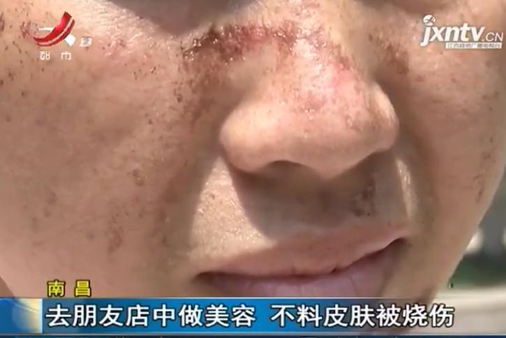 女子10年花了30多万美容差点毁容,女子去美容院做填充毁容