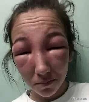 加拿大最危险五大动物,全球十大危险有毒动物