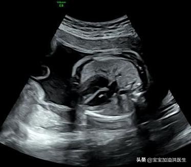 洪医生心脏科,洪医生最新视频