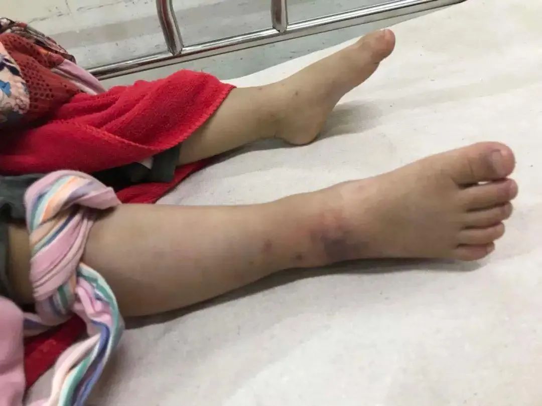 0.08毫克能让人致死，知道我国最毒的蛇有多毒吗？咬后几乎没痛感