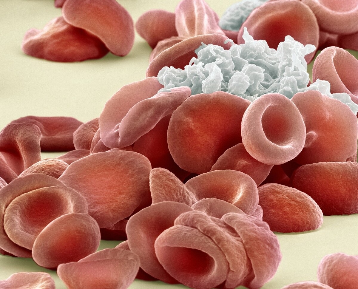 冠心病的联合用药方案有哪些,治疗冠心病的药哪种比较好