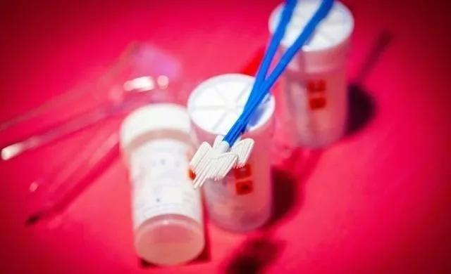 试管前查hpv吗,准备做试管可以打hpv疫苗吗