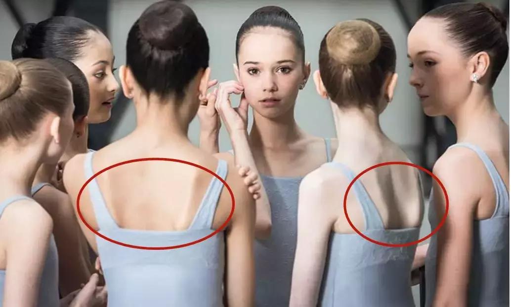 圆肩矫正动画,圆肩体态矫正训练