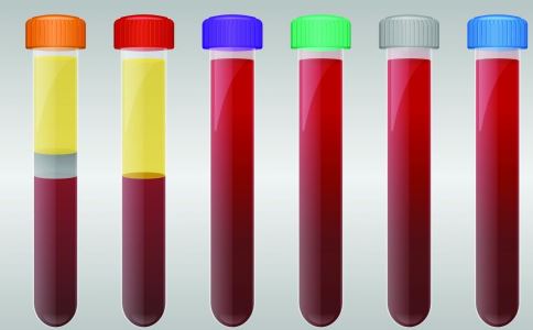 慢性肝病做肝功能检查出来吗,检查肝炎抽血化验要空腹吗