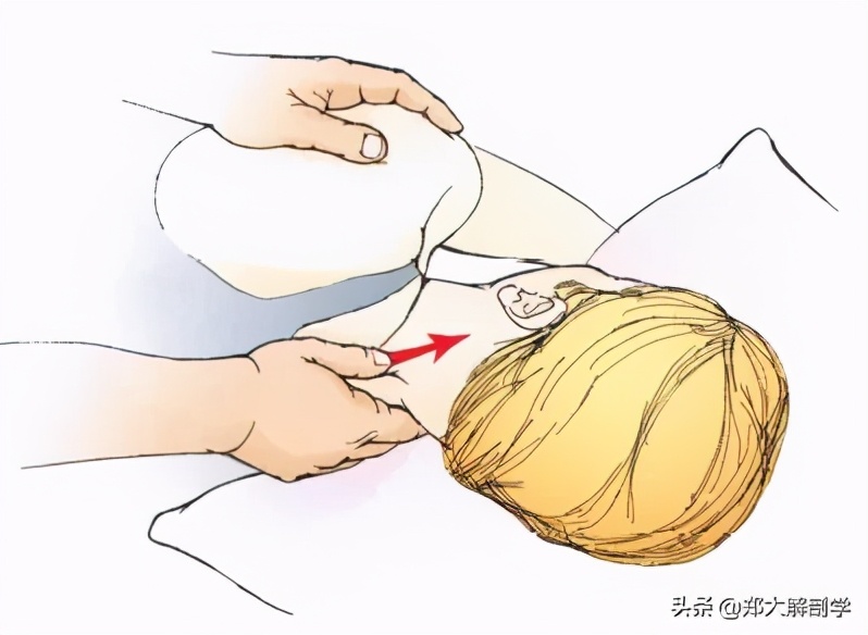 推拿颈椎手法,颈椎手法治疗立竿见影