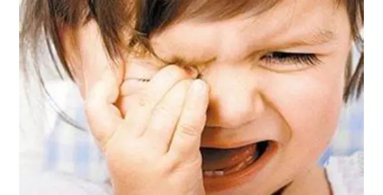 柳絮弄得眼睛痒怎么办,柳絮弄的眼睛痒怎么办