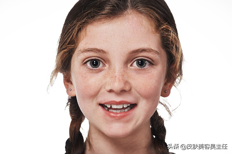 激光祛斑后不红不肿不痛咋回事,激光祛斑没有结痂反而更黑