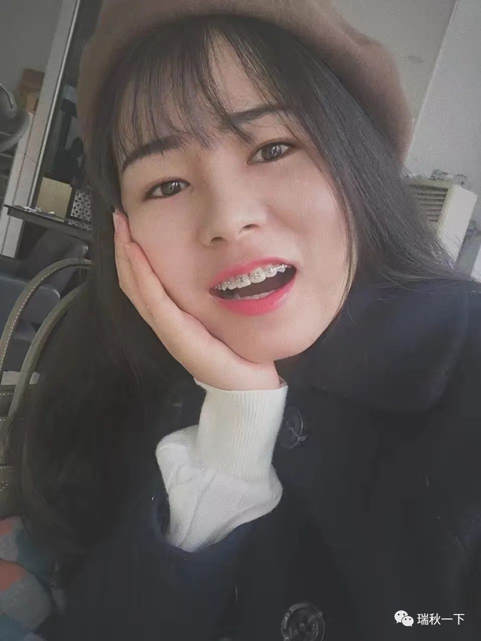 牙齿矫正，你后悔了吗？