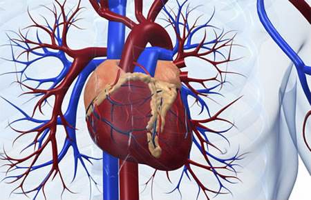 重症冠心病不支架不搭桥怎么办,冠心病三支病变做支架还是搭桥