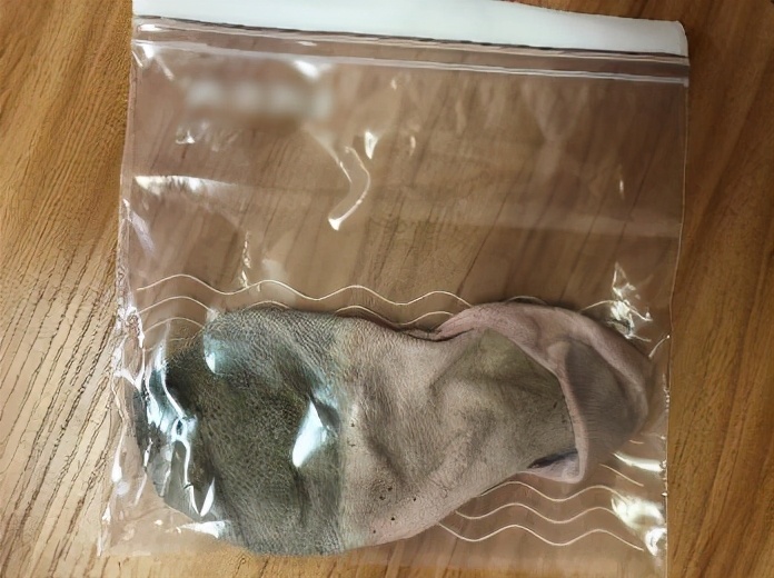 27岁男生脚臭,年轻小伙脚臭