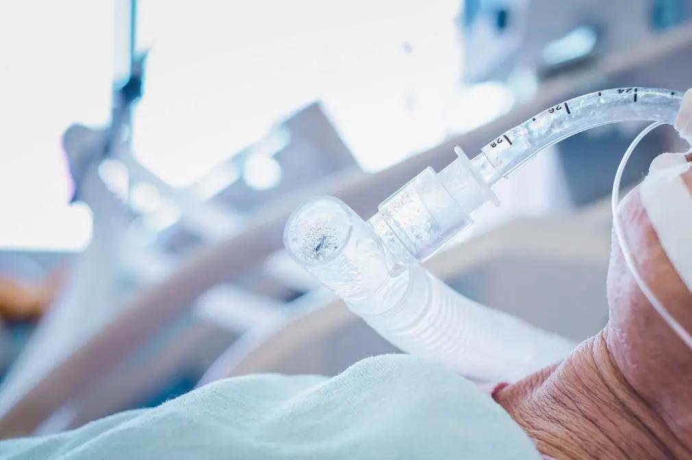 中国哪些呼吸机遭多国疯抢,中国呼吸机紧缺视频