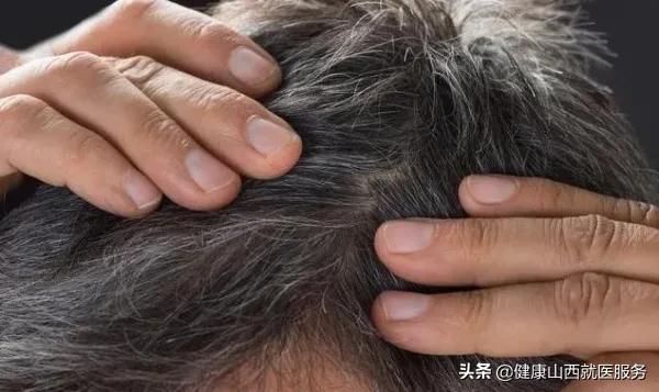 白发多跟什么有关,年龄18岁长了好多白发怎么回事