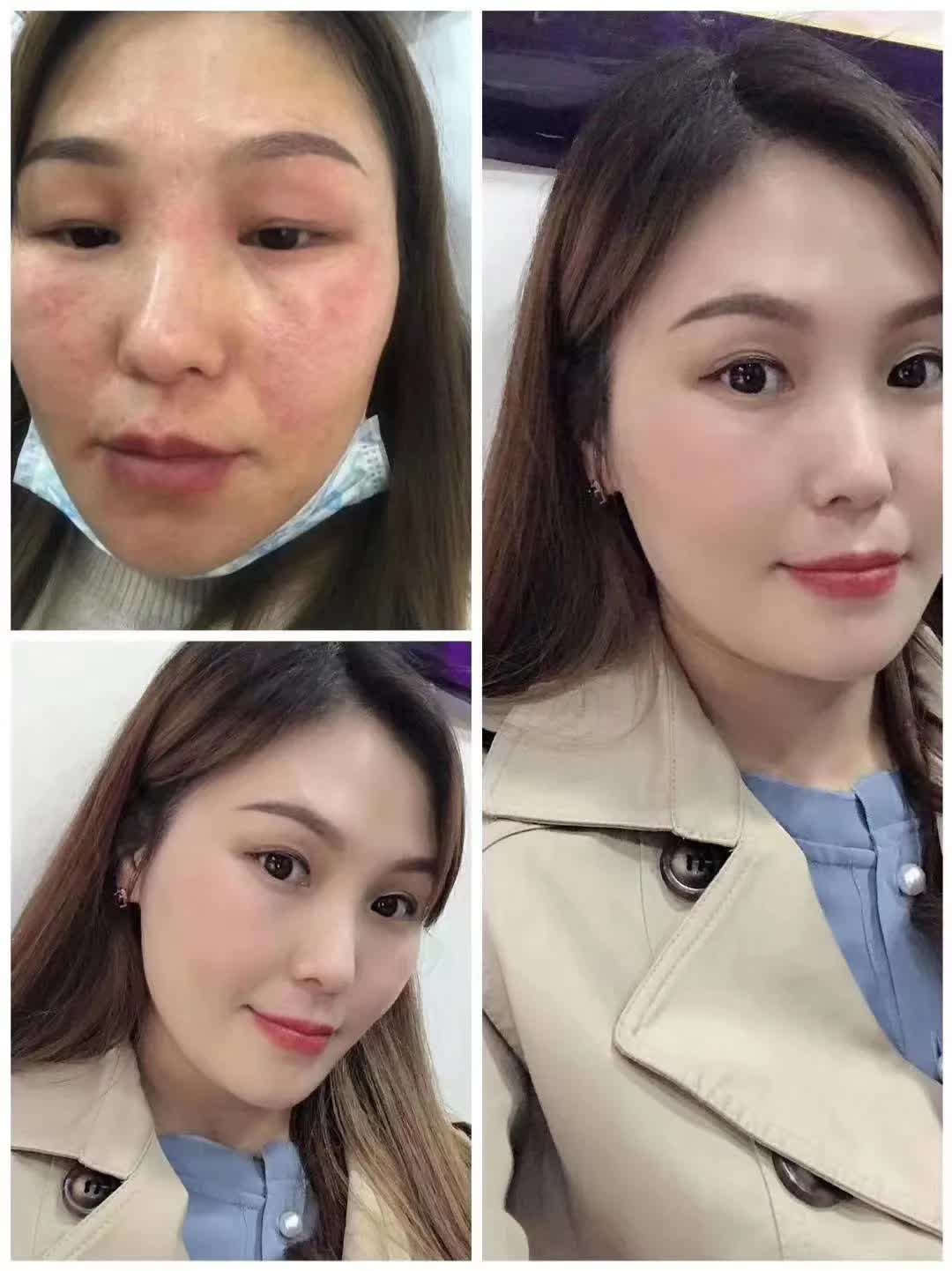 推荐好用的祛斑套盒,祛斑套盒推荐测评