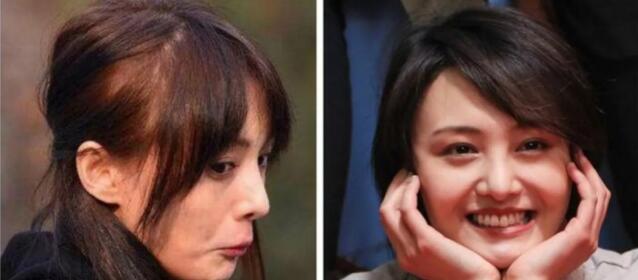 头发细软贴头皮怎么改善,头发细软贴头皮