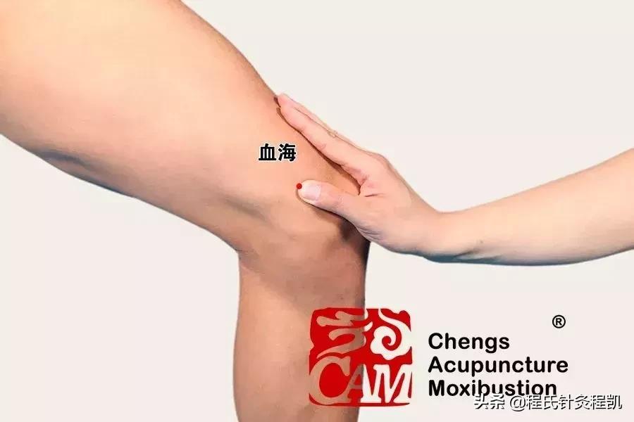 痛经只能默默忍受？中医艾灸调经止痛有奇效