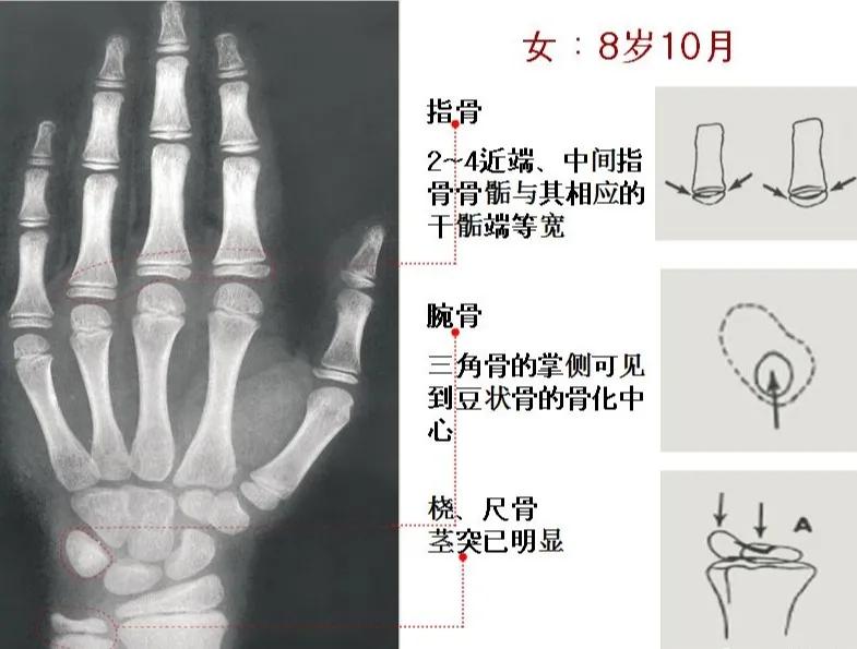 孩子个子高却跑不快,孩子个头不高怎么办