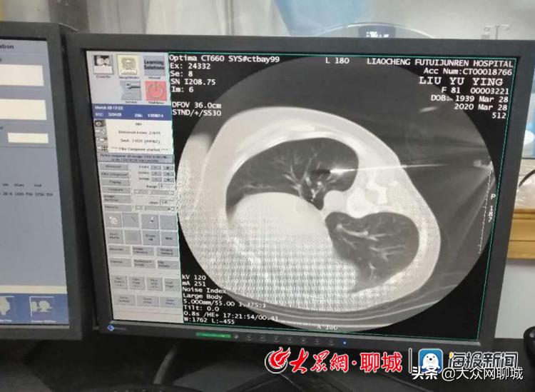 聊城退役军人医院能做手术吗,聊城市人民医院射频消融术