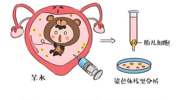 胎儿的大脑发育怎么排查畸形,胎儿有畸形和智力问题能查出来吗