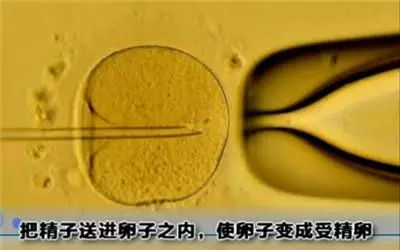 做试管婴儿的全场视频,揭秘试管婴儿的全过程